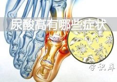 尿酸高有哪些症状，4个尿酸高的症状表现