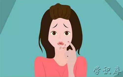 下巴长痘痘是哪里的问题，6个引起下巴长痘痘原因