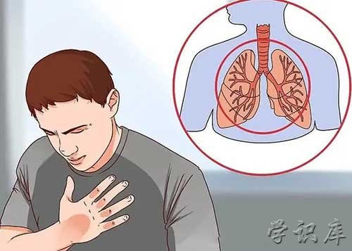 5个征兆说明已有肺癌，肺癌早期5个信号