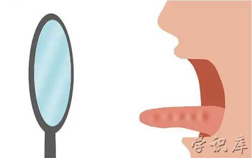 舌头发黑怎么回事，6个舌头发黑的原因