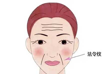 法令纹去除最好的方法，5个方法快速消除法令纹